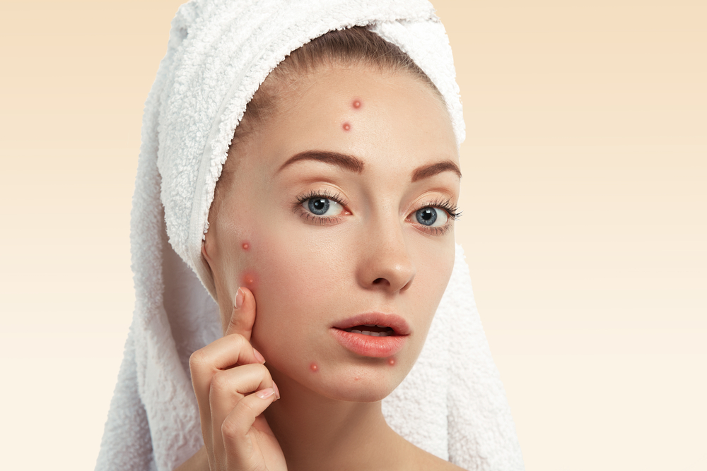 foods-to-avoid-foods-to-eat-to-reduce-pimples-iskincarereviews