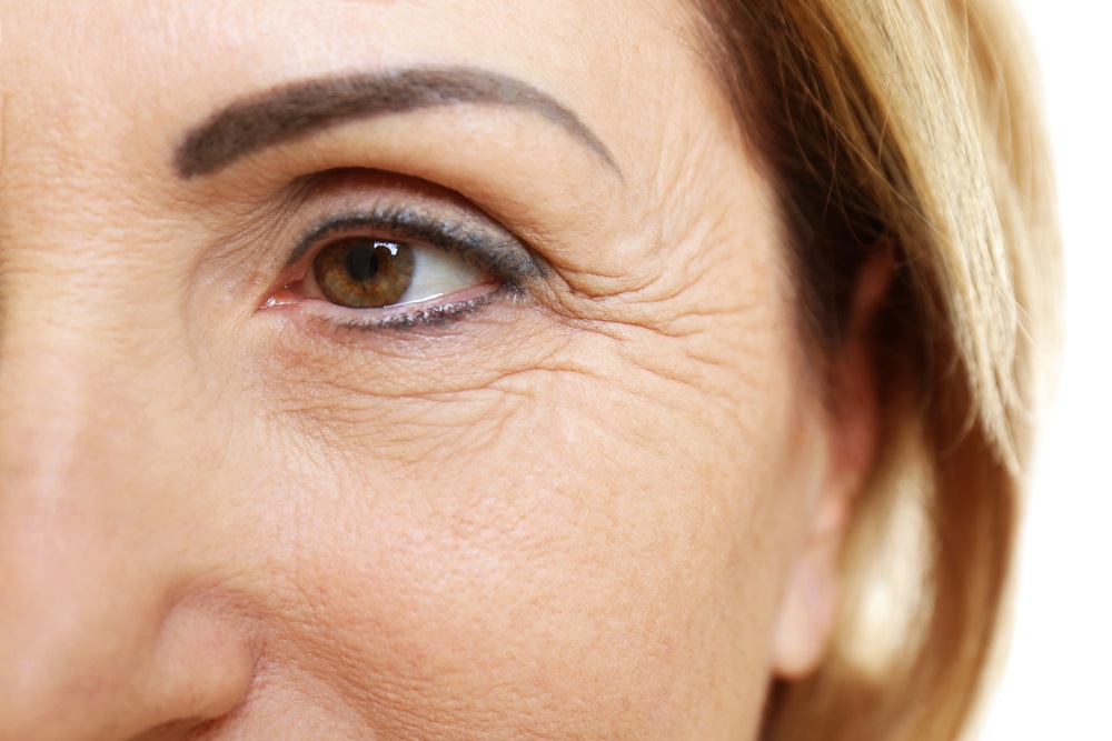 the-first-things-to-do-when-you-start-seeing-wrinkles